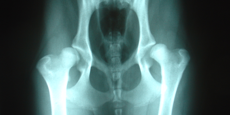 hip dysplasia xray